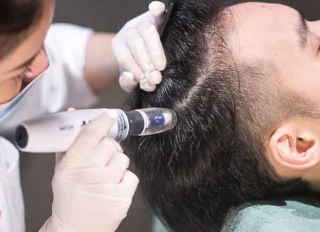 مزونیدلینگ مزوتراپی